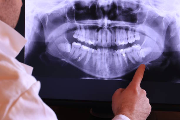 Best Emergency Treatment for Toothache in East Shoreham, NY